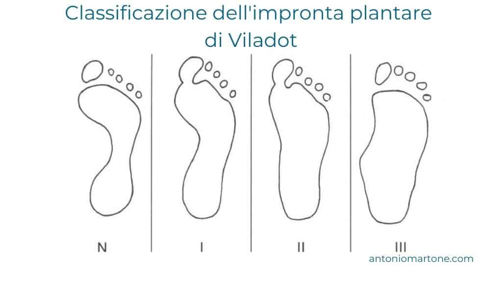 classificazione del piede piatto